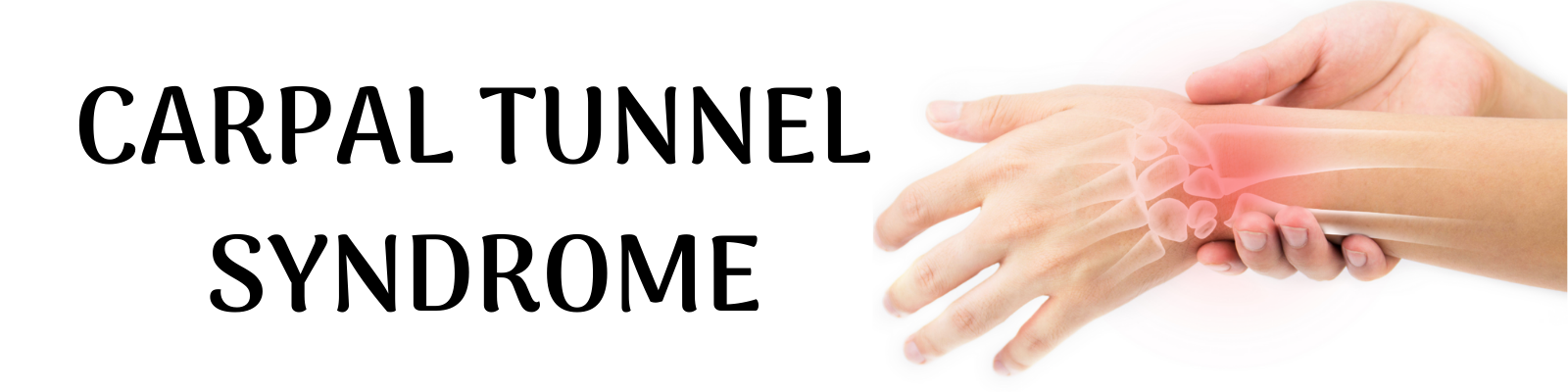 Carpal Tunnel Syndrome Signs and Symptoms | carpal tunnel syndrome ...